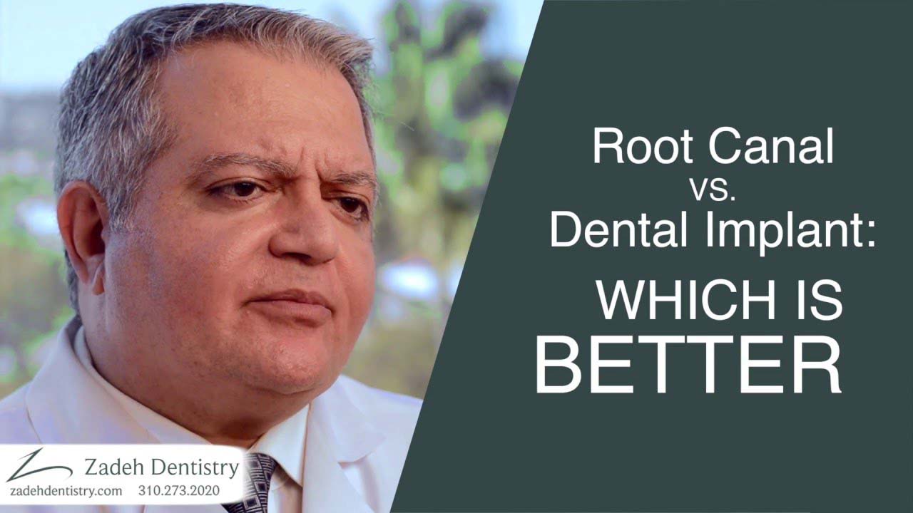 Root Canal vs. Dental Implant: Which is BETTER?
